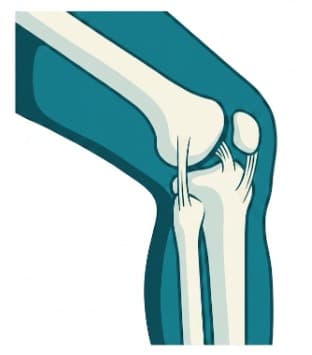 Orthopaedic