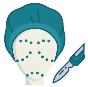 Plastic Surgery