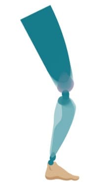 Prostheses
